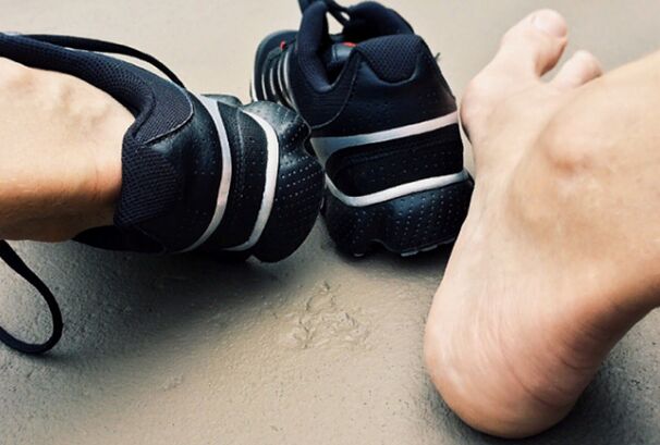 Les causes de l'apparition de la mycose des jambes
