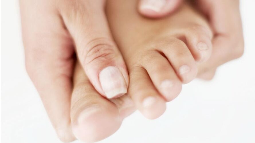 démangeaisons dues à une mycose des ongles sur le gros orteil